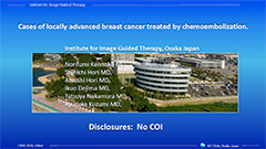 Cases of locally advanced breast cancer treated by chemoembolization.