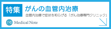 がんの血管内治療